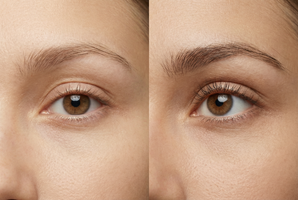 eyelashes castor oil nanolash